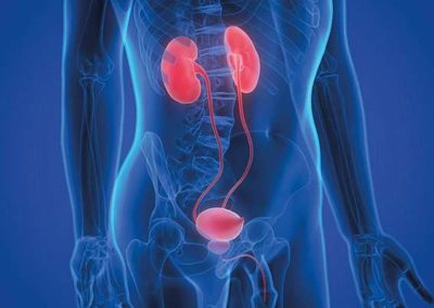 harnwegbeschwerden-400x284