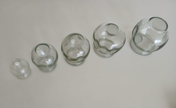 Schröpfgläser-Set – Bild 2