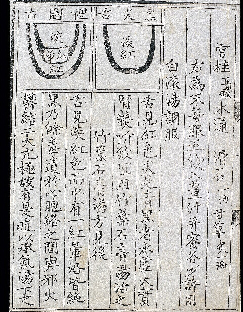 Chinese_tongue_diagnosis_diagram_Wellcome_L0039592 diagnose-tcm